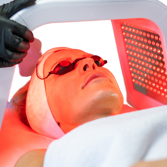 Acne Facial
